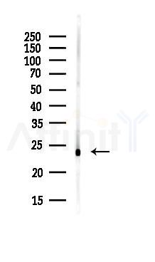 EFNA1 Antibody - Western blot analysis of lysates from HepG2 cells(starvation,24h treatment), using EFNA1 Antibody at 1/1000 dilution.