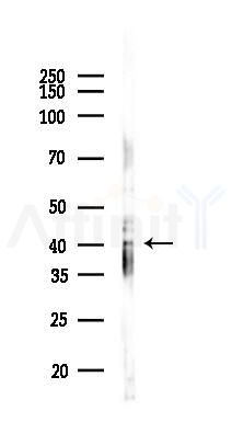 GTF2A1 Antibody - Western blot analysis of lysates from EC304 cells(UV,30min treatment), using GTF2A1 Antibody at 1/1000 dilution.