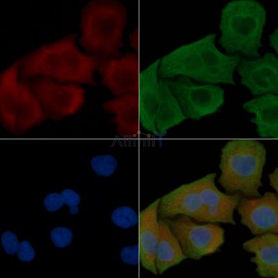 CYB5 Antibody - DF7321 staining Hela cells(45min of heat-shock) by IF/ICC.