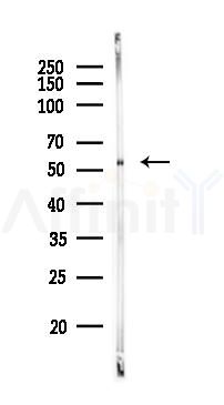DLD Antibody - Western blot analysis of lysates from Rat testis, using DLD Antibody at 1/1000 dilution.