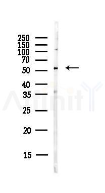 DLD Antibody - Western blot analysis of lysates from PC12 cells(LPS,4h treatment), using DLD Antibody at 1/1000 dilution.