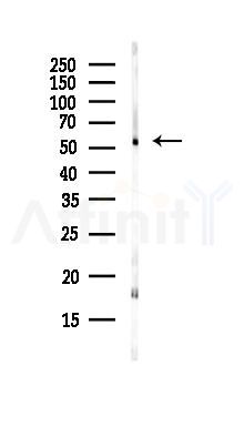 DLD Antibody - Western blot analysis of lysates from HepG2 cells(starvation,24h treatment), using DLD Antibody at 1/1000 dilution.