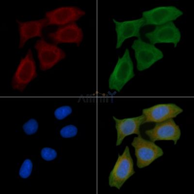 eEF2K Antibody - DF7323 staining Hela cells(45min of heat-shock) by IF/ICC.