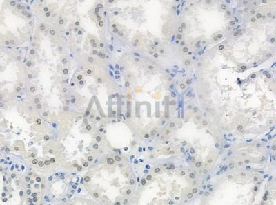 HUS1 Antibody - DF7326 at 1/100 staining human normal kidney tissue by IHC-P.