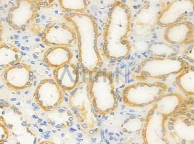 NDUFA13 Antibody - DF7330 at 1/100 staining human normal kidney tissue by IHC-P.
