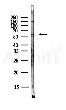 RIPK3 Antibody - Western blot analysis of lysates from PC12 cells(LPS,4h treatment), using RIPK3 Antibody at 1/1000 dilution.