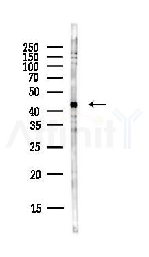 Glutamine Synthetase Antibody - Western blot analysis of lysates from PC12 cells(LPS,4h treatment), using Glutamine Synthetase Antibody at 1/1000 dilution.