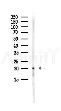 TPT1 Antibody - Western blot analysis of lysates from HepG2 cells(starvation,24h treatment), using TPT1 Antibody at 1/1000 dilution.