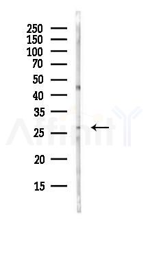 ERAB Antibody - Western blot analysis of lysates from HepG2 cells(starvation,24h treatment), using ERAB Antibody at 1/1000 dilution.