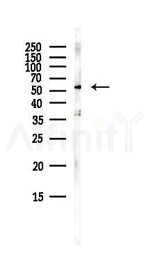 GDI1 Antibody - Western blot analysis of lysates from Mouse lung, using GDI1 Antibody at 1/1000 dilution.
