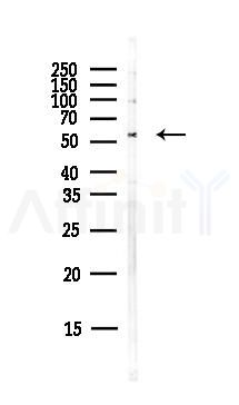 GDI1 Antibody - Western blot analysis of lysates from PC12 cells(LPS,4h treatment), using GDI1 Antibody at 1/1000 dilution.