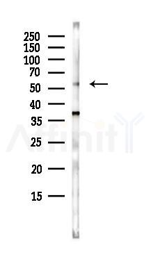 GDI1 Antibody - Western blot analysis of lysates from HepG2 cells(starvation,24h treatment), using GDI1 Antibody at 1/1000 dilution.