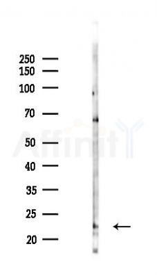 NUDT1 Antibody - Western blot analysis of lysates from Mouse testis, using NUDT1 Antibody at 1/1000 dilution.