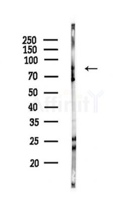 PFKM Antibody - Western blot analysis of lysates from HepG2 cells(starvation,24h treatment), using PFKM Antibody at 1/1000 dilution.
