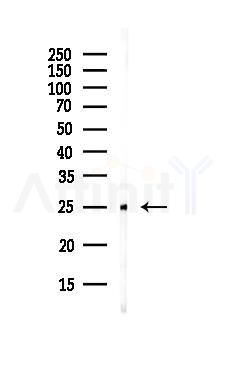 SIGMAR1 Antibody - Western blot analysis of lysates from HepG2 cells(starvation,24h treatment), using SIGMAR1 Antibody at 1/1000 dilution.