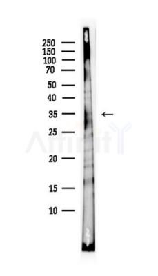 PSRC1 Antibody - Western blot analysis of lysates from Hela cells(starvation,24h treatment), using PSRC1 Antibody at 1/1000 dilution.