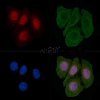 HNRNPF Antibody - DF7383 staining Hela cells(45min of heat-shock) by IF/ICC.