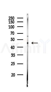 NK1R Antibody - Western blot analysis of lysates from Rat testis, using NK1R Antibody at 1/1000 dilution.