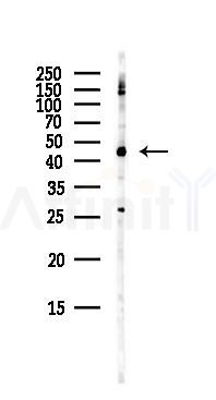 NK1R Antibody - Western blot analysis of lysates from Mouse lung, using NK1R Antibody at 1/1000 dilution.