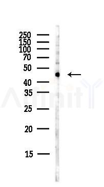NK1R Antibody - Western blot analysis of lysates from PC12 cells(LPS,4h treatment), using NK1R Antibody at 1/1000 dilution.