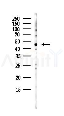 NK1R Antibody - Western blot analysis of lysates from HepG2 cells(starvation,24h treatment), using NK1R Antibody at 1/1000 dilution.