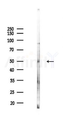 MLKL Antibody - Western blot analysis of lysates from HUVEC cells(UV,30min treatment), using MLKL Antibody at 1/1000 dilution.