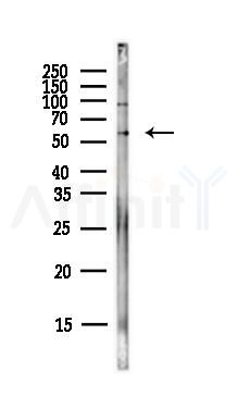ICAM1 Antibody - Western blot analysis of lysates from PC12 cells(LPS,4h treatment), using ICAM1 Antibody at 1/1000 dilution.