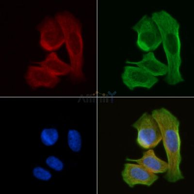 Thymidine Kinase 1/TK1 Antibody - DF7416 staining Hela cells(30min of UV treatment) by IF/ICC.