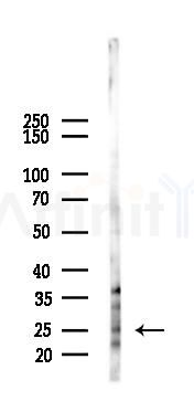 Thymidine Kinase 1/TK1 Antibody - Western blot analysis of lysates from Hela cells(starvation,24h treatment), using Thymidine Kinase 1/TK1 Antibody at 1/1000 dilution.
