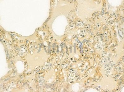 TPP1 Antibody - DF7425 at 1/100 staining human normal lung tissue by IHC-P.