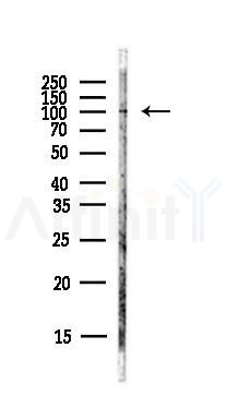 alpha 1 Catenin Antibody - Western blot analysis of lysates from PC12 cells(LPS,4h treatment), using alpha 1 Catenin Antibody at 1/1000 dilution.