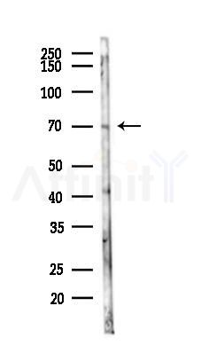 CD105 Antibody - Western blot analysis of lysates from Mouse lung, using CD105 Antibody at 1/1000 dilution.