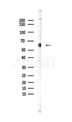 HEXA Antibody - Western blot analysis of lysates from Rat brain, using HEXA Antibody at 1/1000 dilution.
