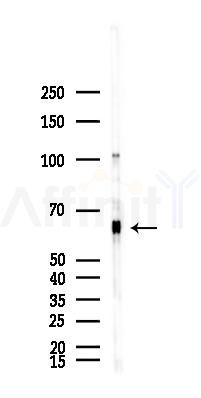 PIAS2 Antibody - Western blot analysis of lysates from B16F10-LUC cells(starvation,24h treatment), using PIAS2 Antibody at 1/1000 dilution.
