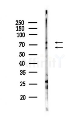 PLAT Antibody - Western blot analysis of lysates from HepG2 cells(starvation,24h treatment), using PLAT Antibody at 1/1000 dilution.