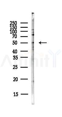 PPARD Antibody - Western blot analysis of lysates from PC12 cells(LPS,4h treatment), using PPARD Antibody at 1/1000 dilution.