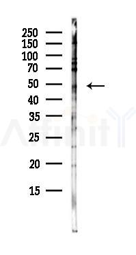 PPARD Antibody - Western blot analysis of lysates from HepG2 cells(starvation,24h treatment), using PPARD Antibody at 1/1000 dilution.