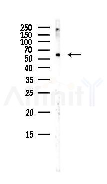 Smad4 Antibody - Western blot analysis of lysates from Mouse lung, using Smad4 Antibody at 1/1000 dilution.