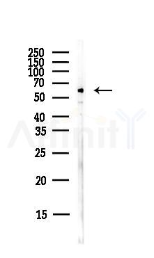 Smad4 Antibody - Western blot analysis of lysates from PC12 cells(LPS,4h treatment), using Smad4 Antibody at 1/1000 dilution.