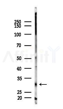 CD74 Antibody - Western blot analysis of lysates from Mouse lung, using CD74 Antibody at 1/1000 dilution.