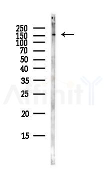 ROCK2 Antibody - Western blot analysis of lysates from Mouse lung, using ROCK2 Antibody at 1/1000 dilution.