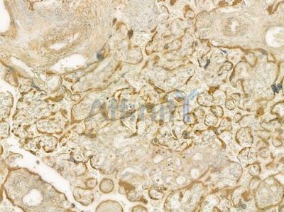 CLCN5 Antibody - DF7469 at 1/100 staining human normal placenta tissue by IHC-P.
