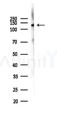 Nephrin Antibody - Western blot analysis of lysates from PC12 cells(UV,30min treatment), using Nephrin Antibody at 1/1000 dilution.