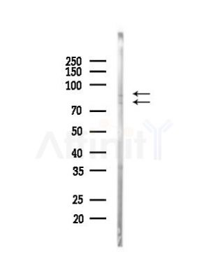 NLRP3 Antibody - Western blot analysis of lysates from HepG2 cells(heat-shock, 45min treatment), using NLRP3 Antibody at 1/1000 dilution.