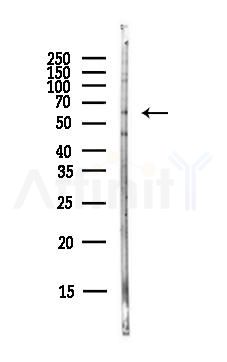 Occludin Antibody - Western blot analysis of lysates from PC12 cells(LPS,4h treatment), using Occludin Antibody at 1/1000 dilution.