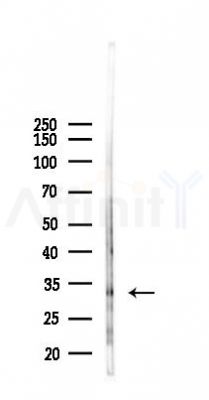 prouty 4 Antibody - Western blot analysis of lysates from Hela cells(heat-shock, 45min treatment), using prouty 4 Antibody at 1/1000 dilution.