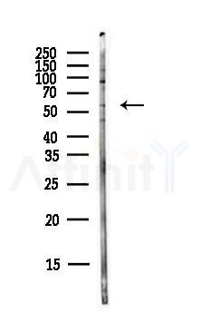GLUT2 Antibody - Western blot analysis of lysates from PC12 cells(LPS,4h treatment), using GLUT2 Antibody at 1/1000 dilution.