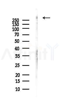 Phospho-ATR (Ser428) Antibody - Western blot analysis of lysates from PC12 cells(LPS, 4h treatment), using Phospho-ATR (Ser428) Antibody at 1/1000 dilution.