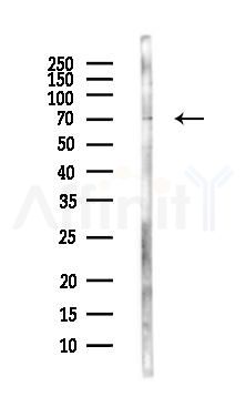CD68 Antibody - Western blot analysis of lysates from PC12 cells(LPS, 4h treatment), using CD68 Antibody at 1/1000 dilution.