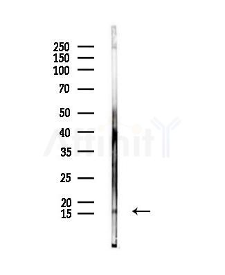 Substance P Antibody - Western blot analysis of lysates from PC12 cells, using Substance P Antibody at 1/1000 dilution.